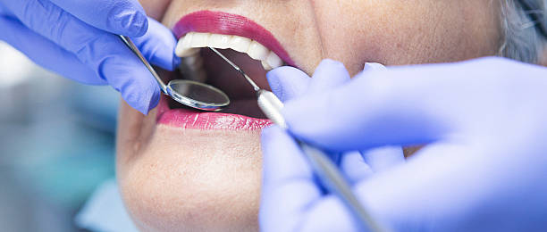 Best Knocked-Out Tooth (Avulsed Tooth) Treatment in Anson, TX